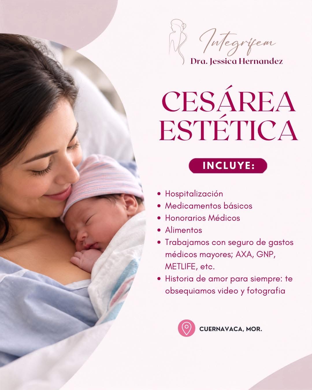 Información sobre cesárea